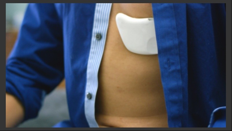 El parche cuenta con un sensor de electrocardiograma que registra toda la información relevante de nuestro corazón con precisión.