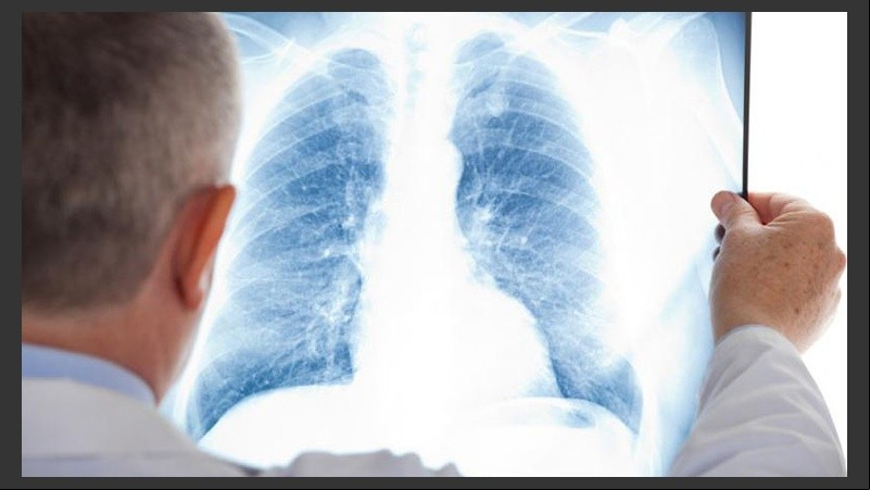 El cáncer de pulmón es el más letal del mundo.