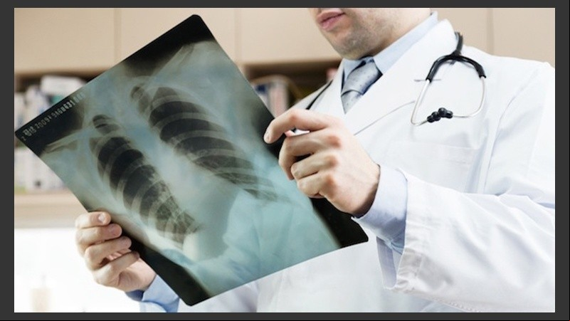 Entre un 10% y un 25% de los casos de cáncer de pulmón se observan en pacientes que nunca fumaron.