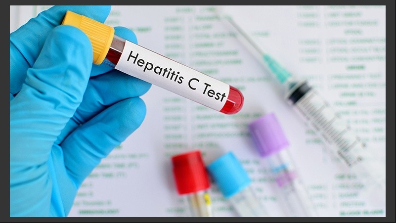 La afección puede ser muy leve o requerir la hospitalización.