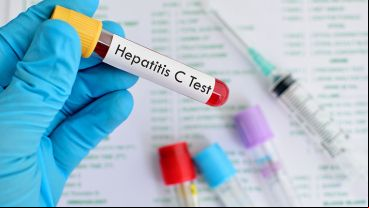 La afección puede ser muy leve o requerir la hospitalización.