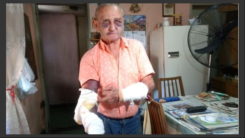 Miguel, el jubilado que sufrió la feroz golpiza. 