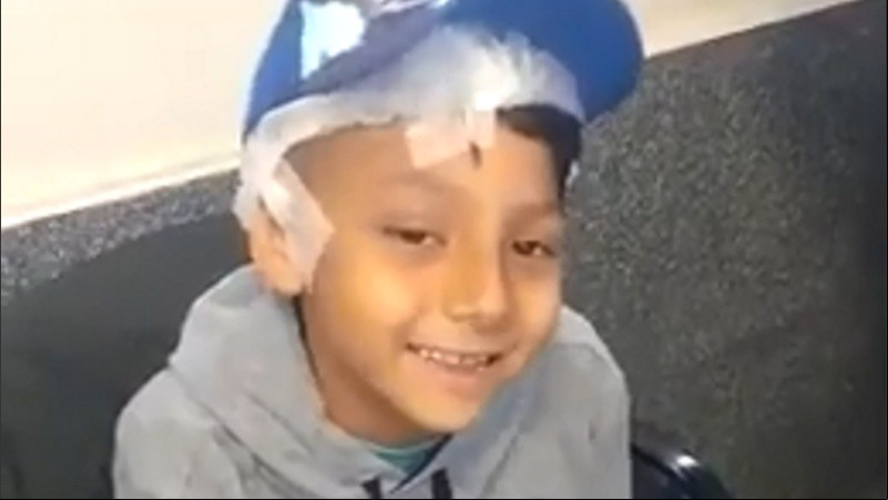 Benjamín pasó su primer fin de semana en casa luego de la operación de muy buen ánimo. 