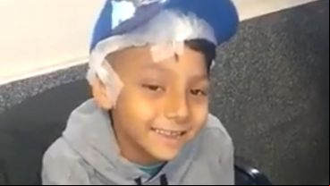 Benjamín pasó su primer fin de semana en casa luego de la operación de muy buen ánimo.
