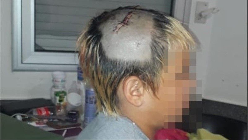 El nene de 10 años que resultó herido en el operativo.