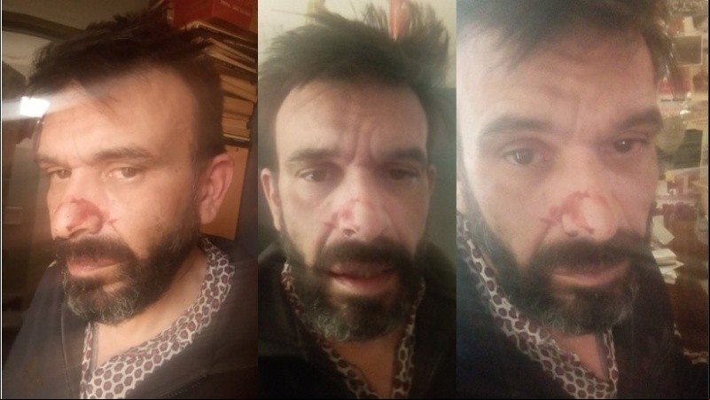 Giacometto compartió fotos de su estado en las redes.