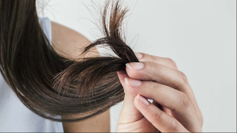 Usuarias denunciaron reacciones adversas al usar productos Bella Hair.