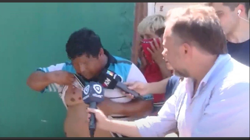 El papá del nene asesinado muestra las heridas por bala de goma. 