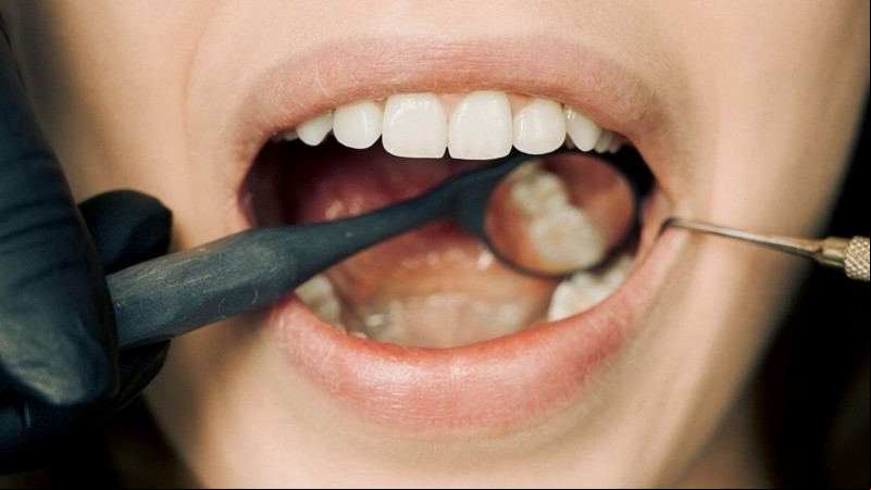 El control odontológico, mínimamente anual, resulta clave para conocer los cuidados particulares de la propia boca.