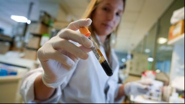 Los casos positivos de dengue se confirman por laboratorio o por nexo epidemiológico.