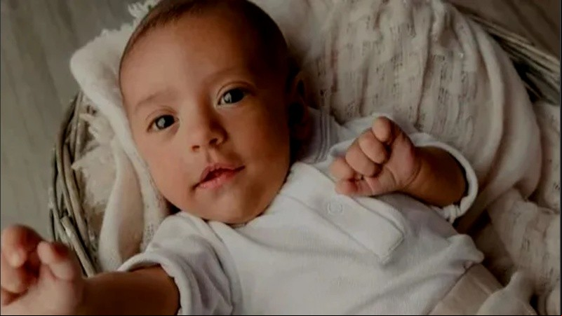 Camilo tiene nueve meses, padece una enfermedad poco frecuente llamada atresia biliiar.