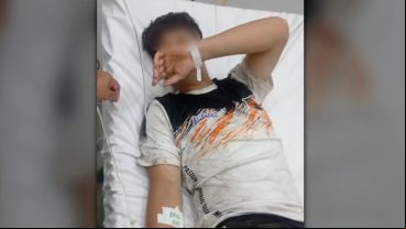 Se recuperaba el adolescente que recibió un palazo en la cabeza durante un partido de la Liga Rosarina.