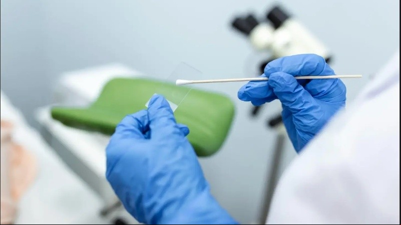 Cien papanicolau para mujeres sin cobertura médica.